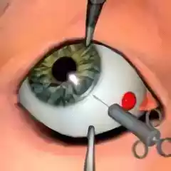 眼科手术中文版游戏